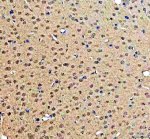 DNA-PKcs Antibody Rat Brain IHC. Immunohistochemical staining of FFPE rat brain tissue using DNA-PKcs antibody. Heat-induced epitope retrieval was performed in pH 8.0 EDTA buffer before incubation with DNA-PKcs antibody at 2 ug/ml. An HRP-conjugated secondary antibody with DAB chromogen was used for visualization. Diffuse nuclear staining is observed throughout the brain parenchyma, consistent with the widespread expression and nuclear localization of DNA-PKcs in neural tissue. This DNA-PKcs Antibody, also called PRKDC Antibody, is suitable for studies of DNA damage repair, non-homologous end joining, genome stability, and DNA repair signaling.