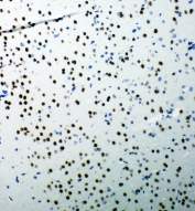 IHC-P: 53BP1 antibody testing of rat brain tissue. HIER: steamed with pH6 citrate buffer.