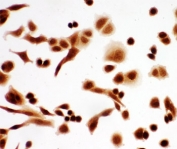 p63 Antibody A549 ICC. Immunocytochemistry testing of human A549 cells with p63 antibody.