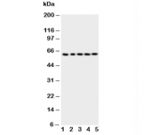 p63 Antibody Human Cell Line WB. Western blot testing of human 1) HeLa, 2) SMMC-7721, 3) COLO-320, 4) A549 and 5) SGC-7901 cell lysate with p63 antibody. Expected molecular weight: 63-77 kDa.