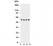 GLUT5 Antibody Human Cell Lines WB. Western blot analysis of GLUT5 expression using a GLUT5 antibody. Lane 1: human U87 cell lysate. Lane 2: human 293T cell lysate. Lane 3: human HT1080 cell lysate. Lane 4: human SW620 cell lysate. GLUT5, also known as SLC2A5 and Fructose Transporter Protein, is a facilitative transporter that mediates fructose uptake and contributes to carbohydrate metabolism and cellular energy homeostasis. A prominent band is detected at approximately 55 kDa in all cell lines, consistent with the expected molecular weight of GLUT5. These results demonstrate endogenous expression of this fructose transporter in diverse human cell types and support the utility of GLUT5 Antibody for studies of nutrient transport, metabolic regulation, and cancer metabolism.