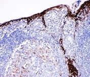 Cystatin A Antibody Tonsil Immunohistochemistry. IHC-P: Cystatin A antibody testing of human tonsil tissue