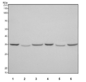 Western blot testing of 1) rat heart, 2) rat skeletal muscle, 3) rat kidney, 4) mouse heart, 5) mouse skeletal muscle and 6) mouse kidney tissue lysate with Taz antibody. Expected/observed molecular weight ~33 kDa.