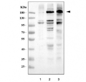 COL1A1 Antibody Human and Mouse Cell Lines WB. Western blot analysis of COL1A1 expression was performed using anti-COL1A1 antibody in human HK2, human HCC, and mouse NIH 3T3 cell lysates. COL1A1 encodes the alpha-1 chain of type I collagen, the major fibrillar collagen responsible for providing structural support and tensile strength to connective tissues. Lane 1: human HK2 lysate. Lane 2: human HCC lysate. Lane 3: mouse NIH 3T3 lysate. Prominent immunoreactive bands are detected between approximately 140-210 kDa, corresponding to precursor forms of COL1A1, with additional bands observed in the expected mature collagen range of approximately 70-90 kDa. Strong expression in fibroblast-derived NIH 3T3 cells and human cell lines is consistent with the established role of type I collagen in extracellular matrix production and tissue remodeling. These results support the utility of COL1A1 Antibody for studies of extracellular matrix biology, fibrosis, connective tissue development, and tumor-associated stromal remodeling.