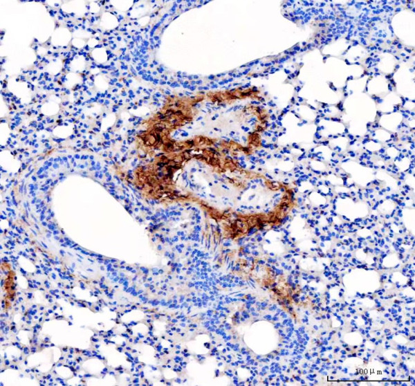 Collagen 1 Antibody Mouse Lung IHC. Immunohistochemistry analysis of Collagen I / COL1A1 expression in FFPE mouse lung tissue using Collagen 1 antibody. HRP-DAB brown staining highlights extracellular collagen fibers outlining bronchial and perivascular structures, forming a supportive connective tissue framework within the lung parenchyma, while surrounding alveolar epithelial cells show minimal intracellular staining; nuclei are counterstained blue. Antigen retrieval was performed by boiling sections in pH 8 EDTA buffer for 20 min followed by cooling prior to staining.