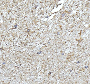 Immunohistochemical staining of FFPE human brain tissue with NDRG2 antibody, HRP-secondary and DAB substrate. HIER: boil tissue sections in pH8 EDTA for 20 min and allow to cool before testing.