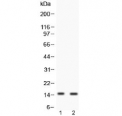 FABP6 Antibody Human Colon Cancer Cells WB. Western blot analysis of FABP6 expression using a FABP6 antibody at 0.5 ug/ml. Lane 1: human COLO320 cell lysate. Lane 2: human SW620 cell lysate. FABP6, also known as Bile Acid Binding Protein and Ileal Lipid Binding Protein, is an intracellular transporter involved in bile acid recycling and lipid homeostasis. A prominent band is detected at approximately 15 kDa in both cell lines, corresponding to the expected molecular weight of FABP6 isoform 1. Although a second isoform of approximately 20 kDa has been reported, only the lower molecular weight species is evident under these conditions. These results demonstrate endogenous expression of FABP6 in human colon cancer cells and support the utility of FABP6 Antibody for studies of bile acid transport, metabolic regulation, and cancer biology.