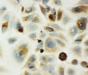 ICC testing of HYAL1 antibody and MCF-7 cells.