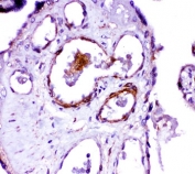ACE Antibody Placenta Immunohistochemistry. IHC-P: ACE antibody testing of human placenta tissue.