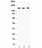 ACE Antibody WB. Western blot testing of ACE antibody and (1) HeLa, (2) A549 and (3) 22RV1 lysate. Expected molecular weight 140-170 kDa.