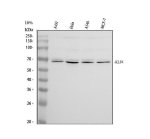 KLF4 Antibody Human Cancer Cell WB. Western blot analysis of KLF4 expression in human cancer cell lines using KLF4 antibody. Lane 1: A431; Lane 2: HeLa; Lane 3: A549; Lane 4: MCF-7. Proteins were resolved on a 10% SDS-PAGE gel, transferred to nitrocellulose, and the membrane was incubated with KLF4 antibody at 0.5 ug/ml followed by an HRP-conjugated secondary antibody. A specific band was detected at the expected molecular weight of approximately 55 kDa in all cell lines examined. This KLF4 Antibody, also called Stem Cell Transcription Factor Antibody, is suitable for studies of pluripotency, cellular reprogramming, epithelial differentiation, transcriptional regulation, and cancer biology.