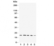 UBD Antibody Human Cell Line Panel WB. Western blot analysis of UBD expression was performed using anti-UBD antibody in multiple human cell line lysates. Lane 1: HeLa. Lane 2: SKOV. Lane 3: MCF-7. Lane 4: A549. Lane 5: SMMC-7721. UBD, also known as FAT10 (Ubiquitin D), is a ubiquitin-like modifier that targets substrate proteins for proteasomal degradation and participates in immune regulation, inflammatory signaling, and cellular stress responses. A specific immunoreactive band is detected at approximately 18â22 kDa in all five cell lines, corresponding to the expected molecular weight range of UBD. The broad expression profile across diverse human cancer cell lines supports the utility of UBD Antibody for studies of ubiquitin-like protein conjugation, proteasomal degradation, immune signaling, inflammation, and cancer biology.