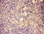 GMCSF Antibody Mouse Spleen Tissue IHC. Immunohistochemistry testing using GMCSF antibody and mouse spleen tissue. HIER: steamed with pH6 citrate buffer.