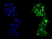 p53 Antibody for IF / Tumor Protein p53 Immunofluorescence Antibody. Immunofluorescence analysis of FFPE human A431 cells demonstrates nuclear localization of p53 detected with p53 Antibody for IF / Tumor Protein p53 Immunofluorescence Antibody (green). Nuclei are counterstained with DAPI nuclear stain (blue). The fluorescence pattern shows strong nuclear enrichment of Tumor protein p53 consistent with TP53 transcription factor localization in carcinoma cells. Heat-induced epitope retrieval was performed by steaming sections in pH6 citrate buffer for 20 minutes prior to immunofluorescence staining and microscopy.