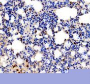 IHC staining of FFPE mouse lung tissue with IL-18 antibody. HIER: boil tissue sections in pH8 EDTA for 20 min and allow to cool before testing.