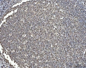 BRCA1 Antibody Tonsil IHC. Immunohistochemistry staining of FFPE human tonsil tissue with BRCA1 antibody. HIER: boil tissue sections in pH8 EDTA for 20 min and allow to cool before testing.