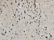 BRCA1 Antibody Mouse Brain IHC. Immunohistochemistry staining of FFPE mouse brain tissue with BRCA1 antibody. HIER: boil tissue sections in pH8 EDTA for 20 min and allow to cool before testing.