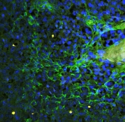 Immunofluorescent staining of FFPE human tonsil tissue with ICAM-1 antibody (green) at 1ug/ml and DAPI nuclear counterstain (blue). HIER: boil tissue sections in pH6, 10mM citrate buffer, for 10-20 min and allow to cool before testing.