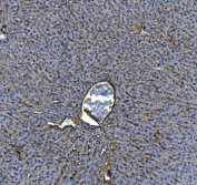 IHC staining of FFPE mouse liver tissue with ICAM1 antibody. HIER: boil tissue sections in pH8 EDTA for 20 min and allow to cool before testing.