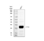 Cathepsin G Antibody Human Monocytic Cell WB. Western blot analysis using Cathepsin G Antibody. Lane 1: human THP-1 cell lysate. A strong, specific band is detected at approximately 29 kDa, consistent with the expected molecular weight of Cathepsin G (CTSG). Detection in the human THP-1 monocytic cell line supports expression of this neutrophil serine protease within cells of the myeloid lineage. These results support the use of Cathepsin G Antibody / Neutrophil Serine Protease Antibody for studying CTSG expression, innate immune responses and neutrophil serine protease biology.
