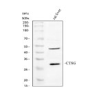 Cathepsin G Antibody Rat Liver WB. Western blot analysis using Cathepsin G Antibody. Lane 1: rat liver tissue lysate. A prominent band is detected at approximately 29 kDa, consistent with the expected molecular weight of Cathepsin G (CTSG). An additional higher molecular weight band is also observed in this tissue lysate. These results support the use of Cathepsin G Antibody / Neutrophil Serine Protease Antibody for detecting Cathepsin G in Western blot applications while illustrating the importance of validating expression patterns in the biological context of individual tissues.
