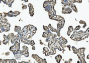 CD34 Antibody Placenta IHC. Immunohistochemistry analysis of CD34 expression in FFPE human placenta demonstrates membranous HRP-DAB brown staining in vascular endothelial cells lining placental villi, highlighting dense capillary networks within the villous stroma, while trophoblastic cells remain largely negative. The staining pattern supports visualization of placental microvascular architecture and endothelial cell distribution. HIER: boil tissue sections in pH8 EDTA for 20 min and allow to cool before testing.
