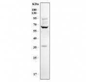 Myeloperoxidase Antibody HL60 WB. Western blot analysis of human HL60 cell lysate using Myeloperoxidase Antibody demonstrates a prominent immunoreactive band at approximately 60-65 kDa, consistent with the expected molecular weight of the myeloperoxidase (MPO) heavy chain. Myeloperoxidase is a heme-containing peroxidase enzyme highly expressed in neutrophils and other myeloid lineage cells, where it contributes to antimicrobial defense through generation of reactive oxidant species. The observed molecular weight is consistent with the mature glycosylated form of MPO, which commonly migrates above its calculated molecular mass due to extensive post-translational glycosylation. Detection in HL60 cells is consistent with the myeloid origin of this cell line and the established expression pattern of MPO during granulocytic differentiation. Expected molecular weight: 59-64 kDa for the alpha/heavy chain, with mature glycosylated forms and precursor species potentially observed at higher molecular weights.