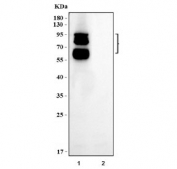Myeloperoxidase Antibody HL60 vs A431 WB. Western blot analysis of human HL60 and A431 cell lysates using Myeloperoxidase Antibody demonstrates strong immunoreactive bands in HL60 cells at approximately 60-65 kDa and 80-90 kDa, while no significant signal is detected in A431 cells. The lower band is consistent with the expected molecular weight of the mature myeloperoxidase (MPO) heavy chain, whereas the higher molecular weight species likely represents glycosylated precursor or processing intermediates of the enzyme. Myeloperoxidase is a heme-containing peroxidase highly expressed in neutrophils and myeloid lineage cells, making its detection in HL60 promyelocytic leukemia cells consistent with the known biology of this model system. The absence of detectable signal in A431 epidermoid carcinoma cells supports the lineage-restricted expression pattern of MPO and further demonstrates antibody specificity. Expected molecular weight: 59-64 kDa for the MPO heavy chain, with higher molecular weight glycosylated and precursor forms commonly observed.