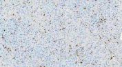 Myeloperoxidase (MPO) Antibody Mouse Liver IHC. Immunohistochemistry staining of FFPE mouse liver tissue using MPO Antibody demonstrates scattered granular cytoplasmic HRP-DAB brown staining within infiltrating myeloid cells distributed throughout the hepatic parenchyma. The staining pattern is consistent with expression of Myeloperoxidase (MPO), a heme-containing lysosomal enzyme characteristically expressed by neutrophils, granulocytes, and other cells of myeloid lineage. MPO-positive cells are observed against a largely negative hepatocellular background, highlighting resident or infiltrating inflammatory populations within the liver tissue. The observed distribution is consistent with the established use of MPO as a marker of granulocytic differentiation, innate immune responses, and myeloid cell identification in normal and inflamed tissues. HIER: heat-mediated antigen retrieval in pH 8.0 EDTA buffer prior to overnight primary antibody incubation and HRP-DAB chromogenic detection.