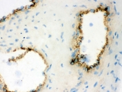 vWF Antibody / Microvessel Density Marker Antibody. Immunohistochemistry analysis of frozen human placental tissue shows HRP-DAB brown staining of endothelial cells outlining microvascular and capillary structures within placental tissue. The staining highlights discrete, endothelial-lined vessel profiles with well-defined luminal borders, enabling clear identification of individual microvessels. This pattern supports visualization and assessment of microvessel density by delineating capillary networks and small vascular channels within the tissue.