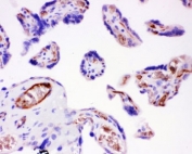 IHC-P: Integrin beta 1 antibody testing of human placenta tissue