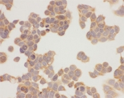 HSP90 alpha Antibody ICC. Immunocytochemistry staining of human MCF-7 cells using HSP90 alpha Antibody / Heat Shock Protein 90 Alpha Antibody demonstrates diffuse cytoplasmic immunoreactivity with minimal nuclear staining. The staining pattern is consistent with expression of HSP90 alpha (HSP90AA1), a highly conserved ATP-dependent molecular chaperone that regulates protein folding, stabilization of client proteins, signal transduction, and cellular stress-response pathways. HSP90 alpha is predominantly localized within the cytoplasm, where it maintains proteostasis and supports the activity of numerous signaling and regulatory proteins involved in cellular growth, survival, and adaptation to physiological stress. The observed staining supports detection of HSP90 alpha expression in cultured human breast adenocarcinoma cells by immunocytochemistry.