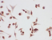 HSP90 alpha Antibody A549 ICC. Immunocytochemistry staining of human A549 cells using HSP90 alpha Antibody / Heat Shock Protein 90 Alpha Antibody demonstrates predominantly cytoplasmic immunoreactivity with weaker nuclear staining. The staining pattern is consistent with expression of HSP90 alpha (HSP90AA1), a highly conserved ATP-dependent molecular chaperone involved in protein folding, stabilization of client proteins, signal transduction, and cellular stress-response pathways. HSP90 alpha is primarily localized within the cytoplasm, where it supports proteostasis and maintains the functional stability of numerous signaling and regulatory proteins. The observed staining supports detection of HSP90 alpha expression in cultured human lung carcinoma cells by immunocytochemistry.