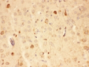 HSP90 alpha Antibody Mouse Brain IHC. Immunohistochemistry staining of FFPE mouse brain tissue using HSP90 alpha Antibody / Heat Shock Protein 90 Alpha Antibody demonstrates diffuse cytoplasmic HRP-DAB brown staining throughout neural tissue with scattered cells exhibiting stronger immunoreactivity. The staining pattern is consistent with expression of HSP90 alpha (HSP90AA1), a highly conserved ATP-dependent molecular chaperone that regulates protein folding, stabilization of client proteins, signal transduction, and cellular stress-response pathways. HSP90 alpha is abundantly expressed in neuronal and glial populations where it contributes to proteostasis, maintenance of cellular homeostasis, and protection against protein misfolding. HIER was performed by steaming tissue sections in pH 6 citrate buffer prior to immunostaining.