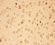 HSP90 alpha Antibody Rat Brain IHC. Immunohistochemistry staining of FFPE rat brain tissue using HSP90 alpha Antibody / Heat Shock Protein 90 Alpha Antibody demonstrates diffuse cytoplasmic HRP-DAB brown staining throughout neural tissue with prominent immunoreactivity in scattered neuronal cell populations. The staining pattern is consistent with expression of HSP90 alpha (HSP90AA1), a highly conserved ATP-dependent molecular chaperone involved in protein folding, stabilization of client proteins, signal transduction, and cellular stress-response pathways. HSP90 alpha plays an essential role in maintaining proteostasis and cellular homeostasis within the nervous system, where it supports the function and stability of numerous signaling and regulatory proteins. HIER was performed by steaming tissue sections in pH 6 citrate buffer prior to immunostaining.