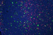 CD3 epsilon Antibody for IF. Immunofluorescence analysis of CD3 Epsilon / CD3E antibody in FFPE human tonsil tissue using a rabbit polyclonal CD3e Immunofluorescence Antibody. CD3-positive T lymphocytes are visualized as bright pink membrane-associated and cytoplasmic fluorescence, predominantly localized within interfollicular regions, consistent with T-cell zone distribution. CD68 monoclonal antibody (green) highlights macrophages within the tissue, while DAPI (blue) marks cell nuclei. The staining demonstrates clear spatial separation between T-cell and macrophage populations and enables visualization of immune cell organization within lymphoid architecture. Heat-induced epitope retrieval was performed by steaming tissue sections in pH 6 citrate buffer for 20 minutes prior to staining.