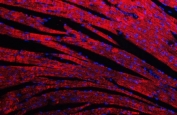 Desmin Antibody for IF Mouse Heart Immunofluorescence. Immunofluorescence analysis of Desmin (DES) expression in FFPE mouse heart tissue using Desmin Antibody for IF demonstrates strong cytoplasmic filamentous red fluorescence in cardiomyocytes, consistent with Desmin localization within the muscle cytoskeletal network, while nuclei are counterstained with DAPI (blue). The staining pattern highlights organized myofibrillar structure and muscle cell architecture, with signal confined to cardiac muscle cells and minimal background in non-muscle components. Heat-induced epitope retrieval was performed by steaming sections in pH8 EDTA buffer for 20 minutes prior to antibody incubation.