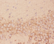 FSH beta Antibody Mouse Brain Immunohistochemistry. IHC-P: FSH beta antibody testing of mouse brain tissue.