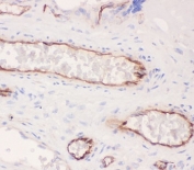 ACE Antibody Placenta IHC. Immunohistochemistry of ACE antibody testing human placenta tissue. HIER: boil tissue sections in pH6, 10mM citrate buffer, for 20 min and allow to cool before testing.