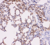 ACE Antibody Mouse Lung IHC. Immunohistochemistry of ACE antibody testing mouse lung tissue. HIER: boil tissue sections in pH6, 10mM citrate buffer, for 20 min and allow to cool before testing.