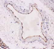 ACE Antibody Rat Lung IHC. Immunohistochemistry of ACE antibody testing rat lung tissue with ACE antibody. HIER: boil tissue sections in pH6, 10mM citrate buffer, for 20 min and allow to cool before testing.