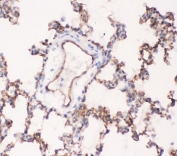 IHC-P testing of rat lung tissue with ACE antibody. HIER: boil tissue sections in pH6, 10mM citrate buffer, for 20 min and allow to cool before testing.