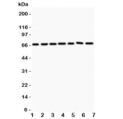 ANG1 Antibody Multi-Cell Line WB. Western blot analysis of Lane 1: HeLa, Lane 2: MCF-7, Lane 3: COLO320, Lane 4: A549, Lane 5: HEPG2, Lane 6: 293T, and Lane 7: SW620 cell lysates using ANG1 Antibody / Angiopoietin 1 Antibody. A band is detected at approximately 57-75 kDa across all tested samples, consistent with Angiopoietin 1 / ANGPT1. The observed molecular weight range reflects variable glycosylation of this secreted vascular growth factor, which is known to influence SDS-PAGE migration. ANGPT1 functions as a ligand for the TEK/TIE2 receptor and plays an important role in endothelial cell survival, vascular stabilization, angiogenic remodeling, and maintenance of blood vessel integrity. The detected expression pattern is consistent with the broad involvement of ANGPT1 signaling in cellular pathways associated with vascular regulation and tissue homeostasis.