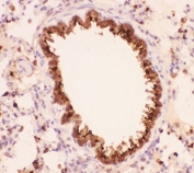 IHC-P: Annexin A1 antibody testing of rat lung tissue. HIER: boil tissue sections in pH8 EDTA for 20 min and allow to cool before testing.