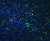 Western blot testing of human 1) Jurkat and 2) HeLa cell lysate with LFA-1 antibody. Expected molecular weight: 85~95 kDa depending on glycosylation level.