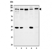 SIRT1 Antibody Human Cell Line WB. Western blot testing of human 1) HepG2, 2) MCF7, 3) SiHA, 4) Daudi and 5) K562 cell lysate with SIRT1 antibody. Expected molecular weight: 82-120 kDa depending on glycosylation level.