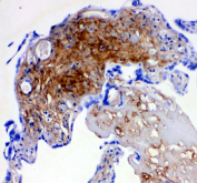IHC analysis of Decorin Antibody / DCN. Decorin staining is observed in a paraffin-embedded section of human placenta tissue, with signal distributed throughout the extracellular matrix and stromal regions. Heat-mediated antigen retrieval was performed using EDTA buffer (pH 8.0). Tissue sections were blocked with 10% goat serum and incubated overnight at 4Â°C with rabbit anti-Decorin antibody, followed by a peroxidase-conjugated goat anti-rabbit IgG secondary antibody. Signal was developed using DAB chromogen, with hematoxylin used for nuclear counterstaining.