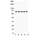 Western blot testing of FOXM1 antibody and Lane 1:  HeLa;  2: COLO320;  3: SW620;  4: SKOV;  5: MCD-7.  Predicted/observed size ~84KD