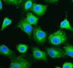 G6PD Antibody Human A549 IF. Immunofluorescent staining of A549 human lung carcinoma cells using G6PD Antibody (green) following enzyme-mediated antigen retrieval and DAPI nuclear counterstaining (blue). G6PD exhibits predominantly cytoplasmic staining, consistent with its role as a cytosolic enzyme in the pentose phosphate pathway responsible for NADPH production and redox homeostasis. This result demonstrates the utility of G6PD Antibody, a Pentose Phosphate Pathway Enzyme Antibody, for investigating G6PD localization, cellular metabolism and oxidative stress responses in cultured human cells.