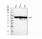 G6PD Antibody Human Cancer Cell WB. Western blot analysis of G6PD Antibody using lysates from lane 1: human HeLa cells, lane 2: human MCF-7 cells and lane 3: human A549 cells. A single prominent band is detected at approximately 59 kDa in all three cell lines, consistent with the predicted molecular weight of endogenous G6PD. These results demonstrate reliable detection of G6PD in human cancer cells and support the use of G6PD Antibody, a Pentose Phosphate Pathway Enzyme Antibody, for studies of cellular metabolism, NADPH production and oxidative stress.